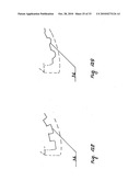 STEADY PRESSURE DENTAL IMPRESSION TRAY AND THE IDEA OF OPERATION diagram and image