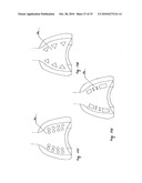 STEADY PRESSURE DENTAL IMPRESSION TRAY AND THE IDEA OF OPERATION diagram and image