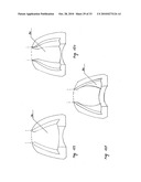 STEADY PRESSURE DENTAL IMPRESSION TRAY AND THE IDEA OF OPERATION diagram and image