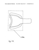 STEADY PRESSURE DENTAL IMPRESSION TRAY AND THE IDEA OF OPERATION diagram and image