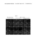 NOVEL USE OF GRP 94 IN VIRUS INFECTION diagram and image