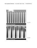 Methods for detecting fetal abnormality diagram and image