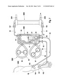 EXTERNAL FUNCTIONAL MEANS, BLOOD TREATMENT APPARATUS FOR RECEIVING AN EXTERNAL FUNCTIONAL MEANS IN ACCORDANCE WITH THE INVENTION, AND METHOD diagram and image