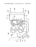 EXTERNAL FUNCTIONAL MEANS, BLOOD TREATMENT APPARATUS FOR RECEIVING AN EXTERNAL FUNCTIONAL MEANS IN ACCORDANCE WITH THE INVENTION, AND METHOD diagram and image