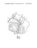 Method and System for Treating Target Tissue Within the Eustachian Tube diagram and image