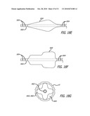 Method and System for Treating Target Tissue Within the Eustachian Tube diagram and image