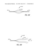 Method and System for Treating Target Tissue Within the Eustachian Tube diagram and image