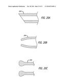 Method and System for Treating Target Tissue Within the Eustachian Tube diagram and image