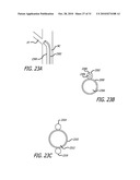 Method and System for Treating Target Tissue Within the Eustachian Tube diagram and image