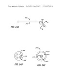 Method and System for Treating Target Tissue Within the Eustachian Tube diagram and image