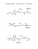 Method and System for Treating Target Tissue Within the Eustachian Tube diagram and image