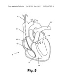 PRESSURE MONITORING TO CONTROL DELIVERY OF THERAPEUTIC AGENT diagram and image