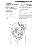 ARTIFICIAL GASTRIC VALVE diagram and image