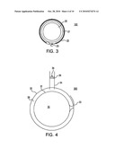 ARTIFICIAL GASTRIC VALVE diagram and image