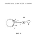 ARTIFICIAL GASTRIC VALVE diagram and image