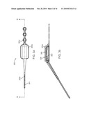 Implantable Neurostimulator with Integral Hermetic Electronic Enclosure, Circuit Substrate, Monolithic Feed-Through, Lead Assembly and Anchoring Mechanism diagram and image