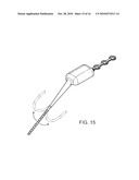 Implantable Neurostimulator with Integral Hermetic Electronic Enclosure, Circuit Substrate, Monolithic Feed-Through, Lead Assembly and Anchoring Mechanism diagram and image