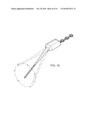 Implantable Neurostimulator with Integral Hermetic Electronic Enclosure, Circuit Substrate, Monolithic Feed-Through, Lead Assembly and Anchoring Mechanism diagram and image