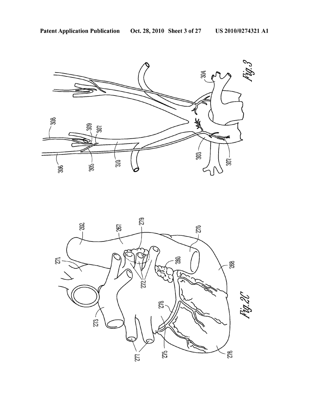 BAROREFLEX ACTIVATION THERAPY WITH CONDITIONAL SHUT OFF - diagram, schematic, and image 04