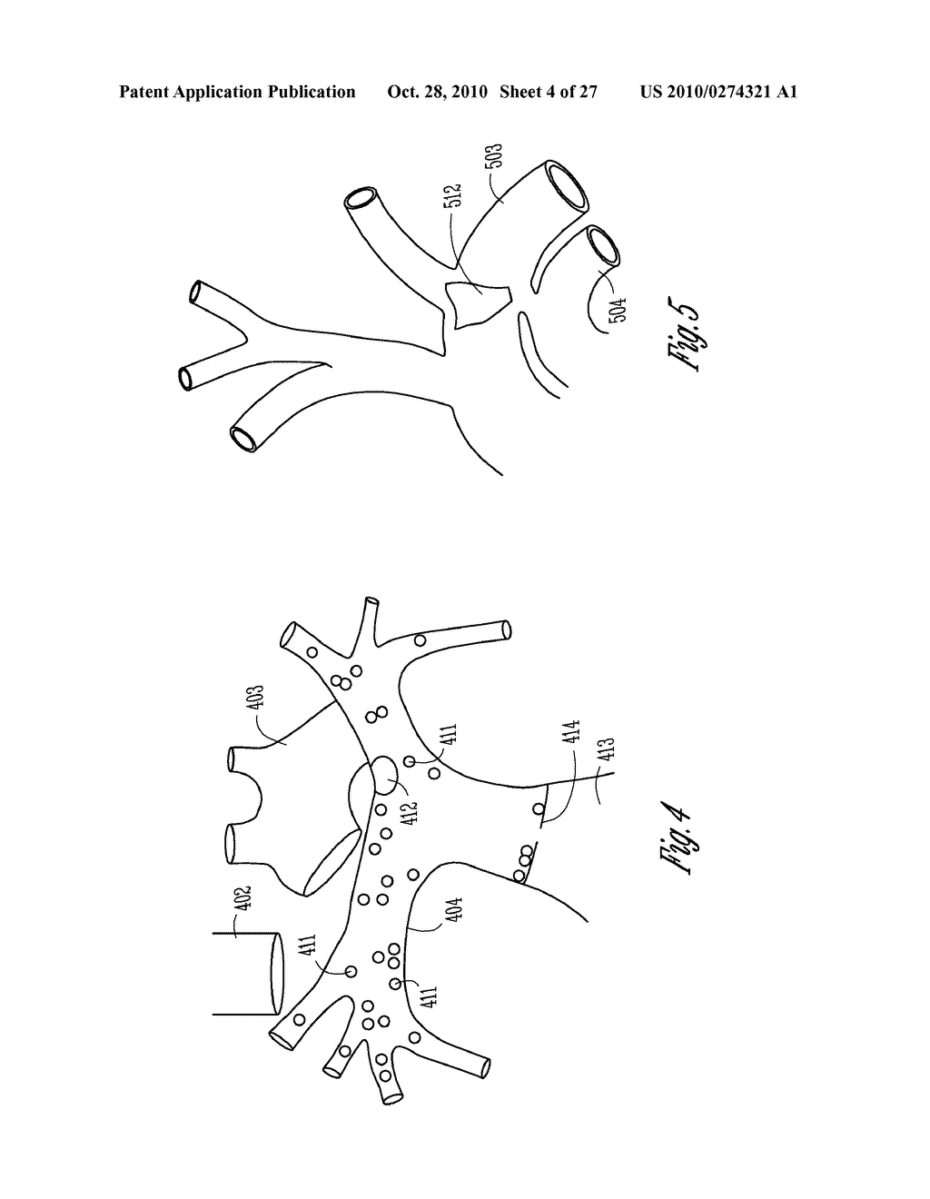 BAROREFLEX ACTIVATION THERAPY WITH CONDITIONAL SHUT OFF - diagram, schematic, and image 05