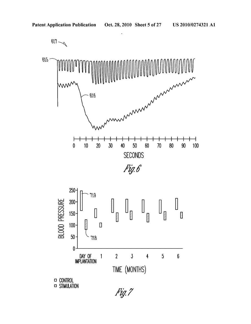 BAROREFLEX ACTIVATION THERAPY WITH CONDITIONAL SHUT OFF - diagram, schematic, and image 06