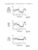 BAROREFLEX ACTIVATION THERAPY WITH CONDITIONAL SHUT OFF diagram and image