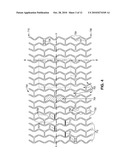 Stents with High Radial Strength and Methods of Manufacturing Same diagram and image