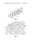 Stents with High Radial Strength and Methods of Manufacturing Same diagram and image