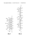 Stents with High Radial Strength and Methods of Manufacturing Same diagram and image