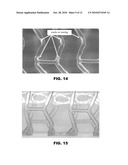 Stents with High Radial Strength and Methods of Manufacturing Same diagram and image