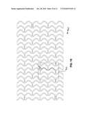 Stents with High Radial Strength and Methods of Manufacturing Same diagram and image