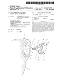 JOINT PROSTHESIS ATTACHMENT SYSTEM, DEVICE AND METHOD diagram and image