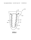 ADJUSTABLE PROSTHESIS diagram and image