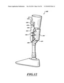 ADJUSTABLE PROSTHESIS diagram and image