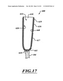 ADJUSTABLE PROSTHESIS diagram and image