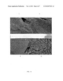 DRUG DELIVERY FROM STENTS diagram and image