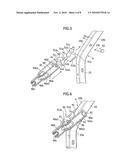 Opening and closing device for automobile trunk lid diagram and image