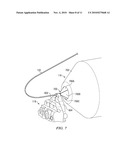 Apparatus and method for customized shaping of orthodontic archwires and other medical devices diagram and image