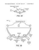 INERTIAL SENSING SYSTEM WITH A CURVED BASE AND A DIAMAGNETIC MASS diagram and image