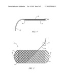 STORAGE VESSEL AND METHOD OF FORMING diagram and image