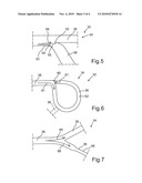 Support Structure for an Airbag diagram and image