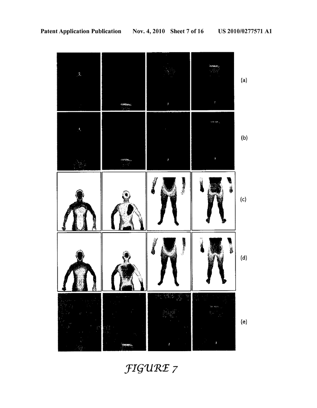 Body Surface Imaging - diagram, schematic, and image 08