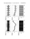 JITTER-FREE SPATIAL TRIGGERING OF A DETECTOR OF A CT SYSTEM diagram and image