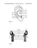 EARPIECE diagram and image