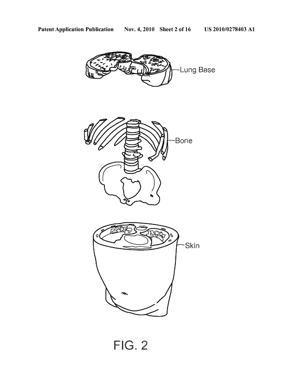 Lumen Tracking in Computed Tomographic Images - diagram, schematic, and image 03