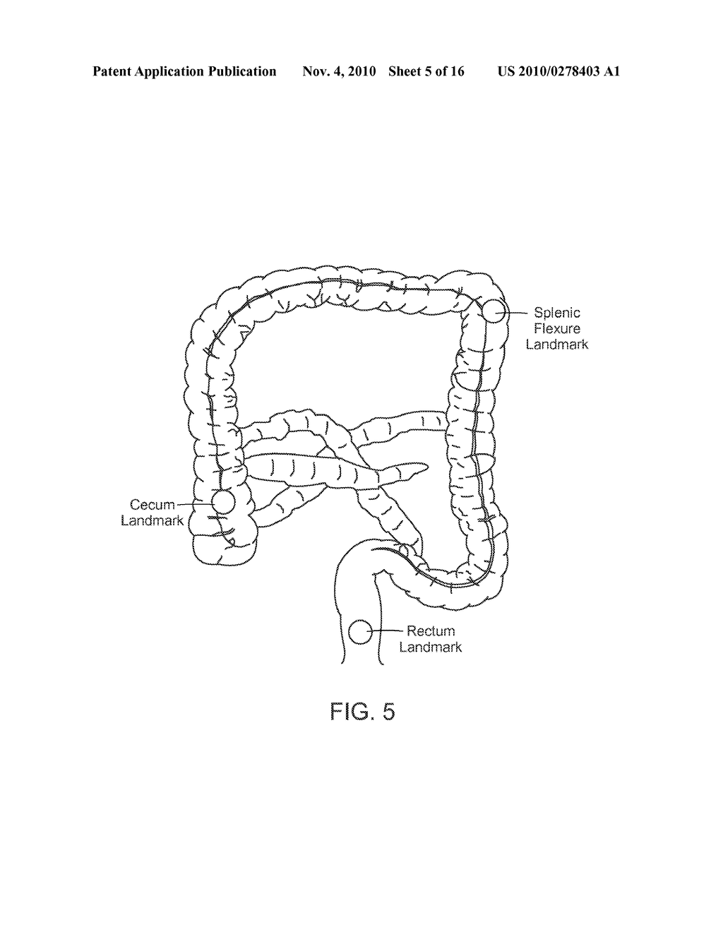 Lumen Tracking in Computed Tomographic Images - diagram, schematic, and image 06