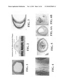 Scoring Method for Imaging-Based Detection of Vulnerable Patients diagram and image