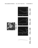 Scoring Method for Imaging-Based Detection of Vulnerable Patients diagram and image