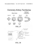 Scoring Method for Imaging-Based Detection of Vulnerable Patients diagram and image