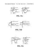 Scoring Method for Imaging-Based Detection of Vulnerable Patients diagram and image